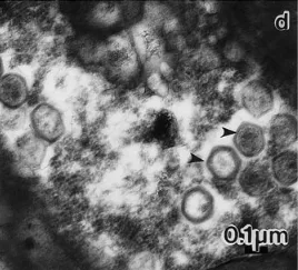 Chrysochromulina ericina virus