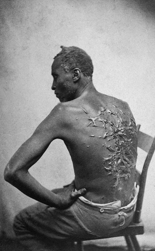 Slavery