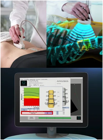 Radiofrequency Echographic Multi Spectrometry