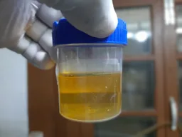 Urine test