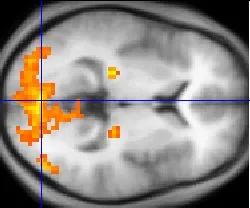 Functional neuroimaging