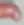 Frenulum breve