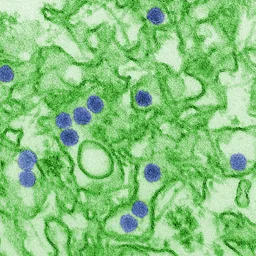 Virus del Zika