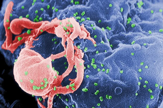 Virus de la inmunodeficiencia humana