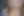 Micropenis