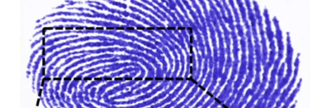 Forensic radiology