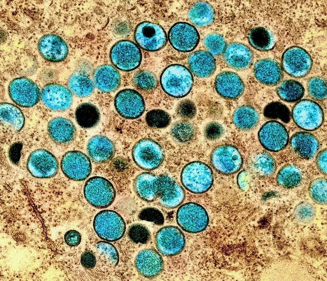 Virus de la viruela del mono